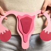 Mengenal PCOS: Gangguan Hormonal yang Kerap Tak Disadari Perempuan