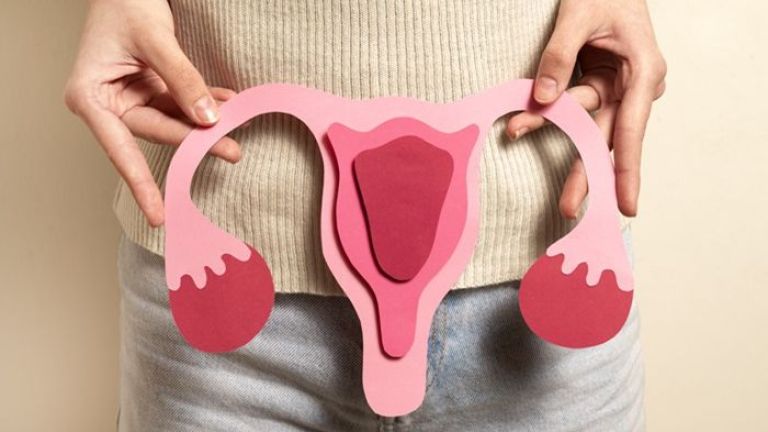 Mengenal PCOS: Gangguan Hormonal yang Kerap Tak Disadari Perempuan