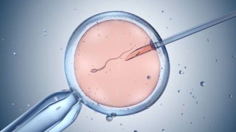 Masih Dianggap Tabu, CEO Smart Fertility Clinic Jelaskan Fakta tentang Program IVF