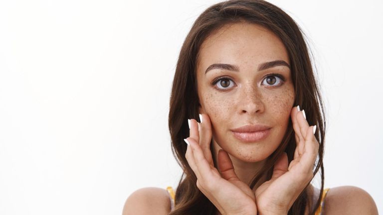 Flek Hitam Susah Hilang? Kenalan dengan Terapi Redermalisasi, Solusi Mutakhir untuk Hempas Melasma