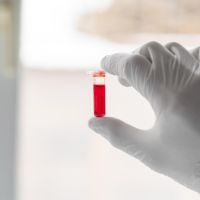 Pentingnya Skrining Dini untuk Cegah Thalasemia Sejak Usia Muda