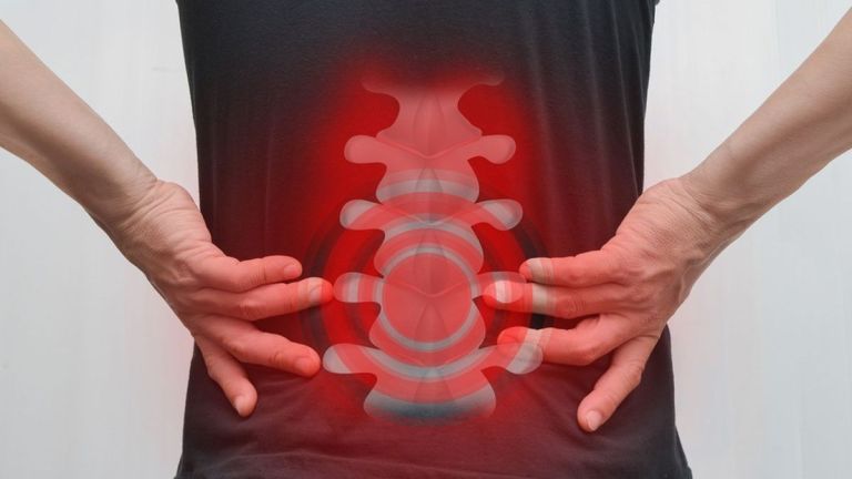 Nyeri Pinggang Belum Tentu Saraf Kejepit, Ini Penjelasan Dokter