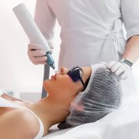 Mau Coba Perawatan Laser? Ini 5 Hal yang Wajib Diperhatikan