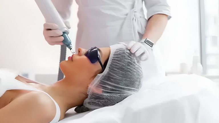 Mau Coba Perawatan Laser? Ini 5 Hal yang Wajib Diperhatikan